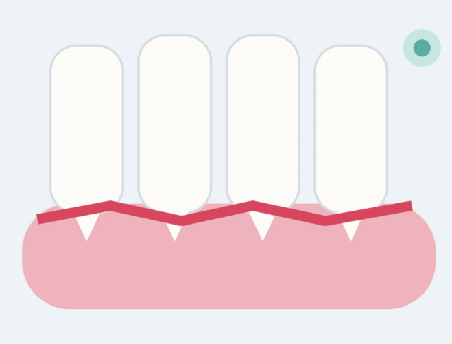 Gingivitis in Cats