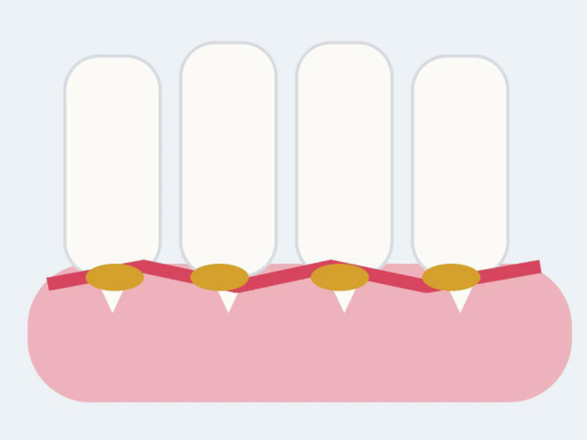 Gingivitis in Cats